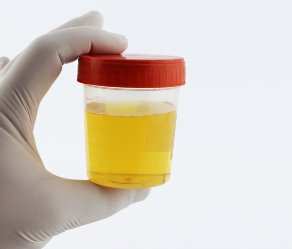 Badanie moczu u psa – klucz do zdrowia Twojego pupila